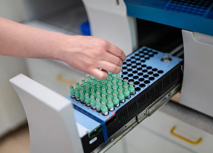 Eine Hand platziert mehrere grüne Reagenzgläser in eine Vorrichtung in einem Labor. Die Umgebung sieht nach einer sterilen Laborumgebung aus.